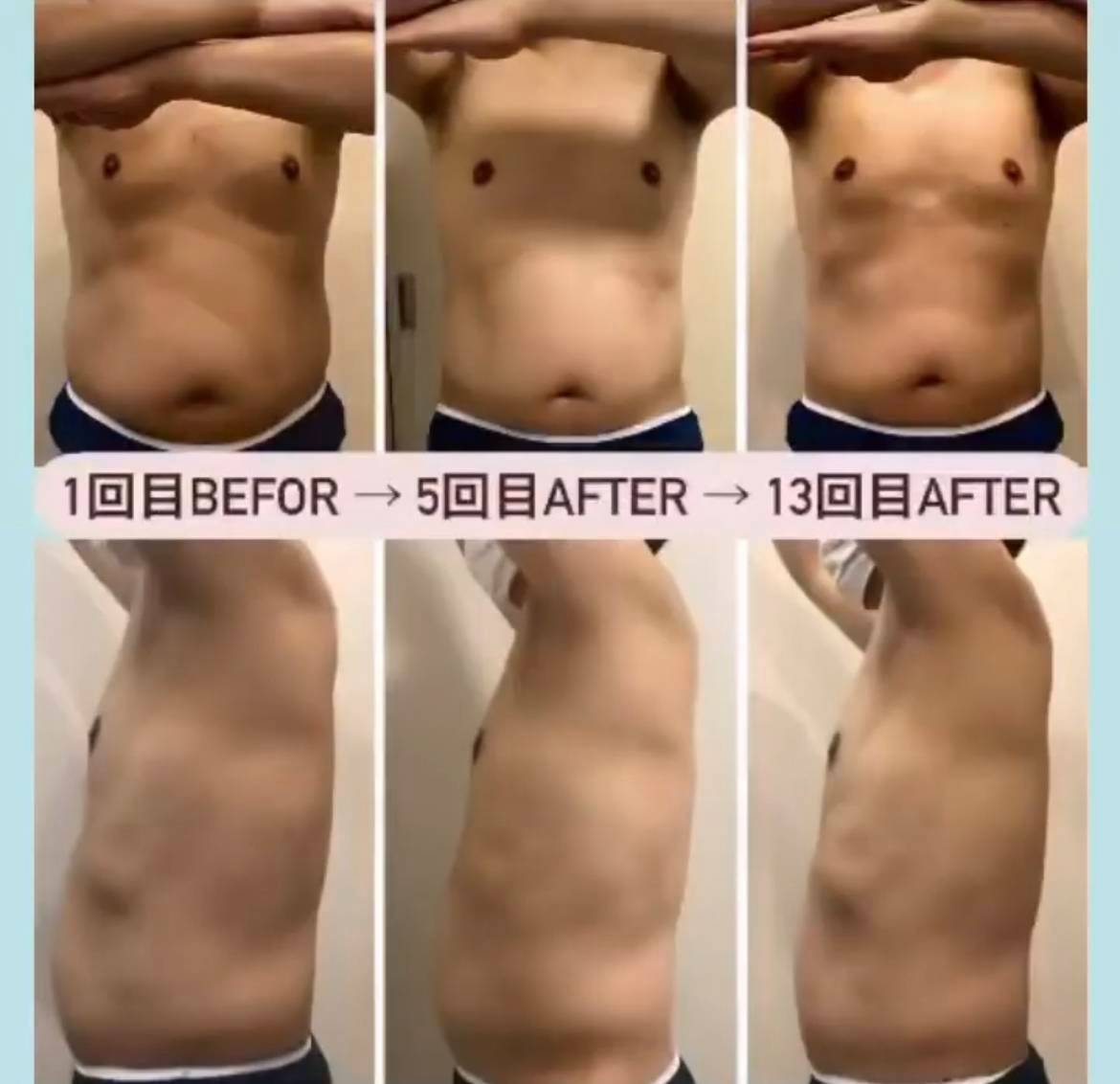 症例